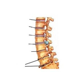 Entwicklungsstadien der Osteochondrose