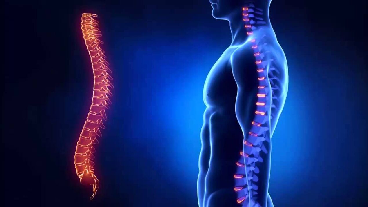 Osteochondrose wird nach den Teilen der Wirbelsäule klassifiziert, in denen sich die Krankheit entwickelt.